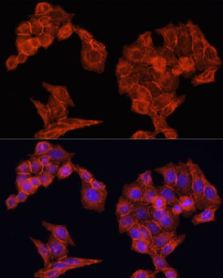 Polyclonal Rabbit anti-Human EGFR Antibody (IHC, IF, WB)