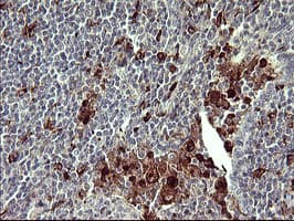 Monoclonal Mouse anti-Human MMP13 Antibody (clone OTI4B3, aa104-471, IHC, IF, WB)