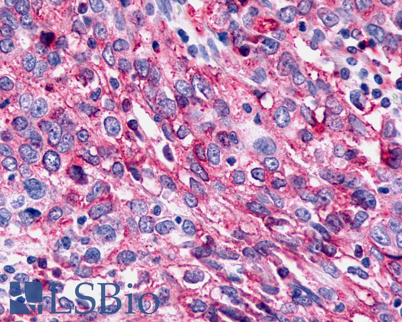 PathPlus™ CELSR3 Antibody (N-Terminus)