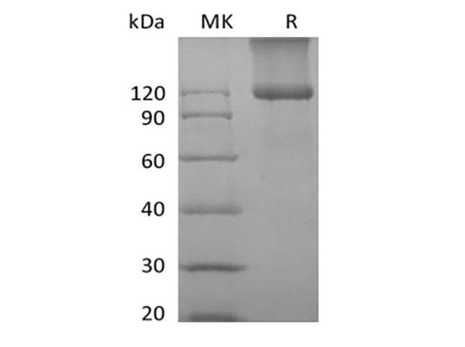 Mouse Betaglycan / TGFBR3 Protein (Recombinant 6His, C-terminus)