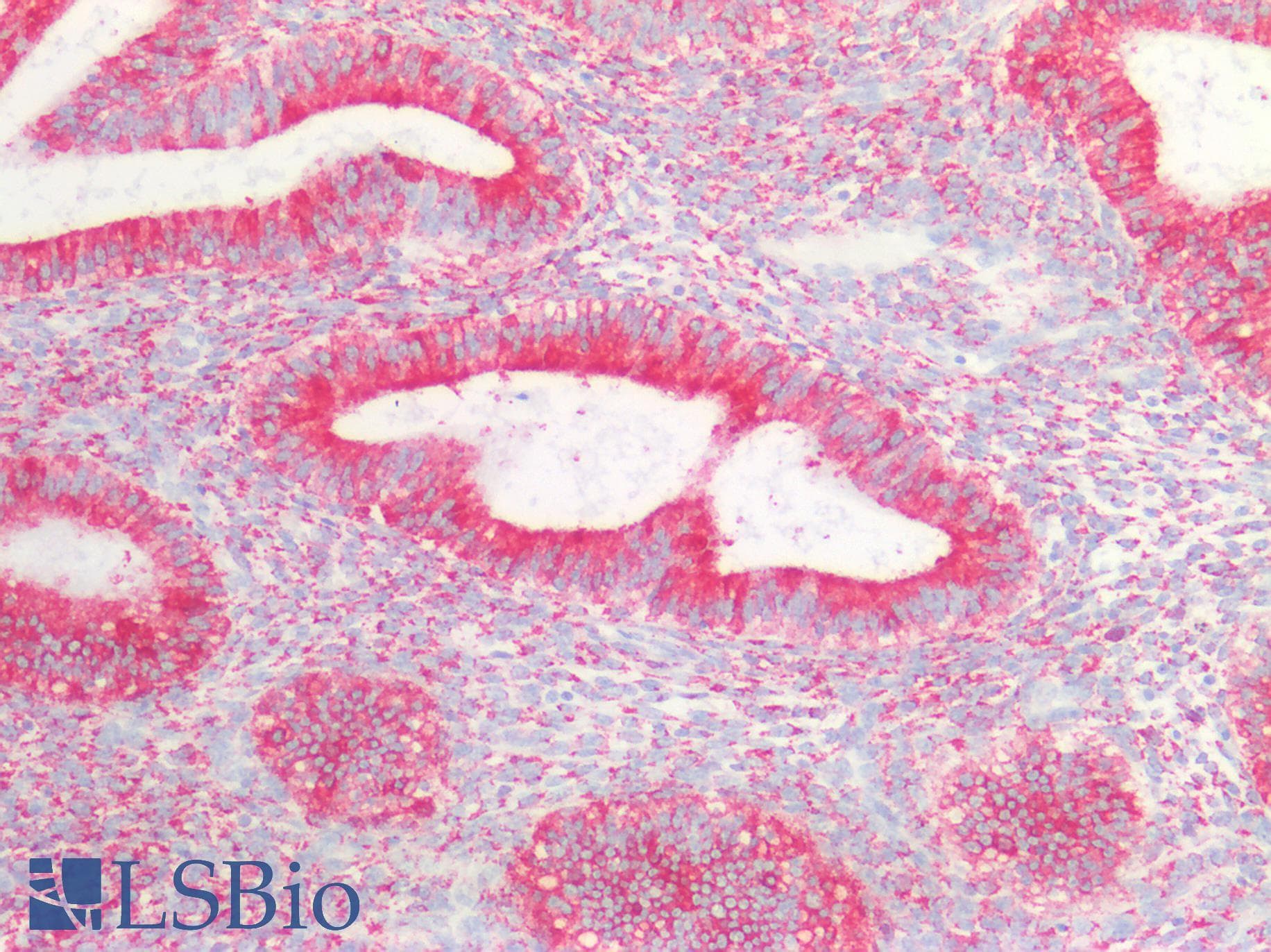 PathPlus™ CANX / Calnexin Antibody (C-Terminus)