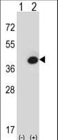 IHC-plus™ FBP1 Antibody (aa125-156)