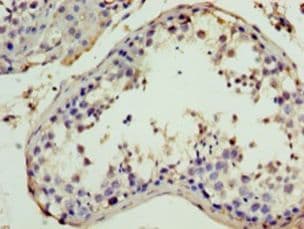 ITIH4 Antibody (aa689-930)
