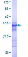 Human SPA17 / Sperm Protein 17 (Recombinant GST, N-terminus)