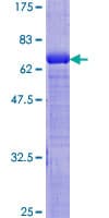 Human GDI2 Protein (Recombinant GST)