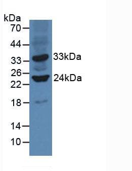 SIRT3 / Sirtuin 3 Antibody (aa5-257, PE)