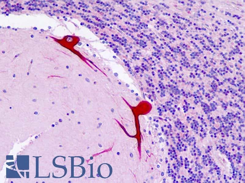 IHC-plus™ DAB1 Antibody (aa187-236)
