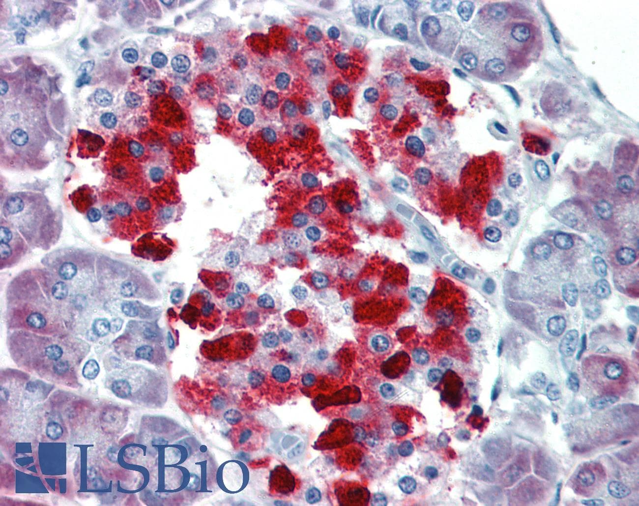IHC-plus™ CASP4 / Caspase 4 Antibody