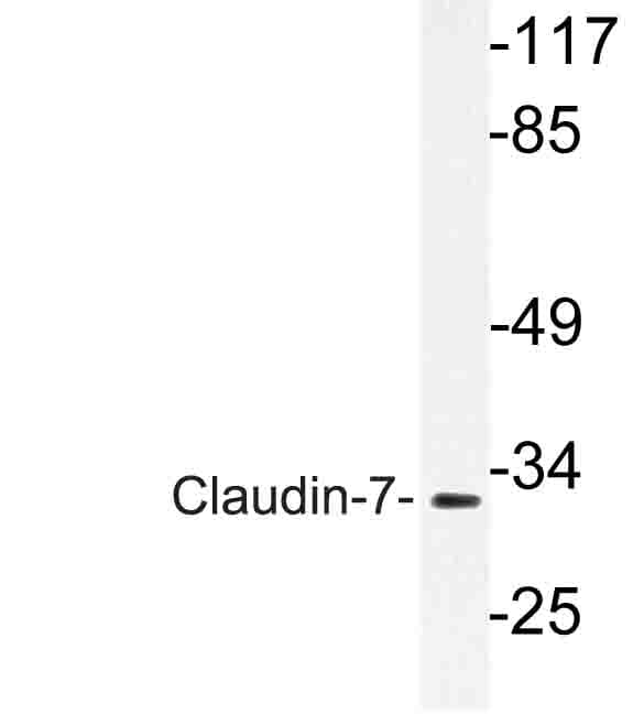 CLDN7 / Claudin 7 Antibody (Ser204)