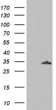 Monoclonal Mouse anti-Human LGALS3 / Galectin 3 Antibody (clone OTI15E4, Carrier-free, IHC, WB)