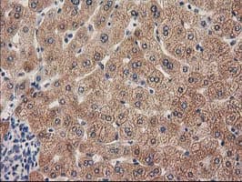 GRHPR / Glyoxylate Reductase Antibody (clone OTI2H4)