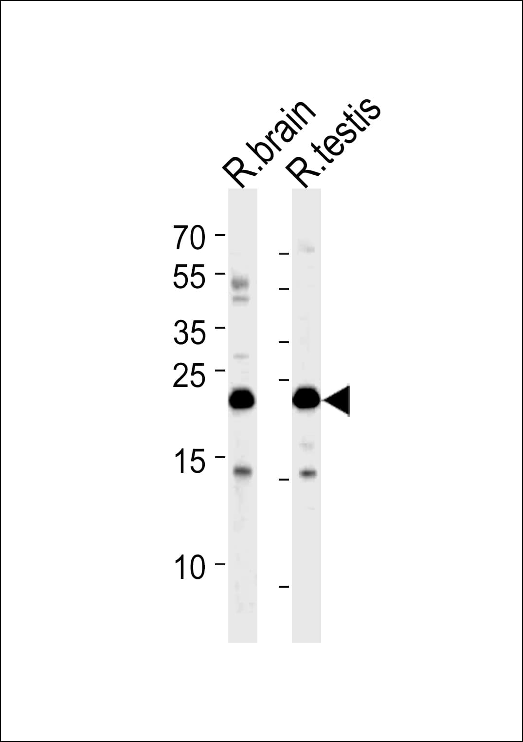 RAB11B Antibody (aa164-193)