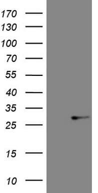 ABCC5 / MRP5 Antibody (clone OTI5F4)