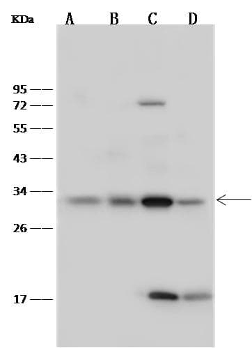Polyclonal Rabbit anti-Human Latexin / MUM Antibody (Preservative Free, IHC, WB)