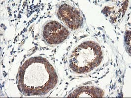 TFG Antibody (clone OTI2C3)