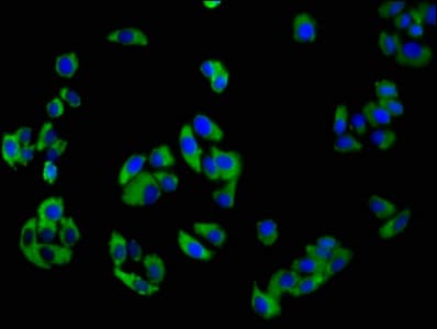 Polyclonal Rabbit anti-Human NKP30 Antibody (IHC)