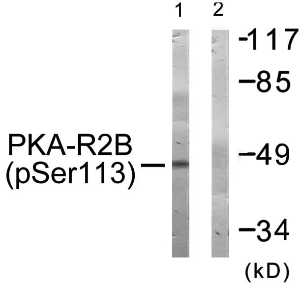 PRKAR2B Antibody (phospho-Ser113)