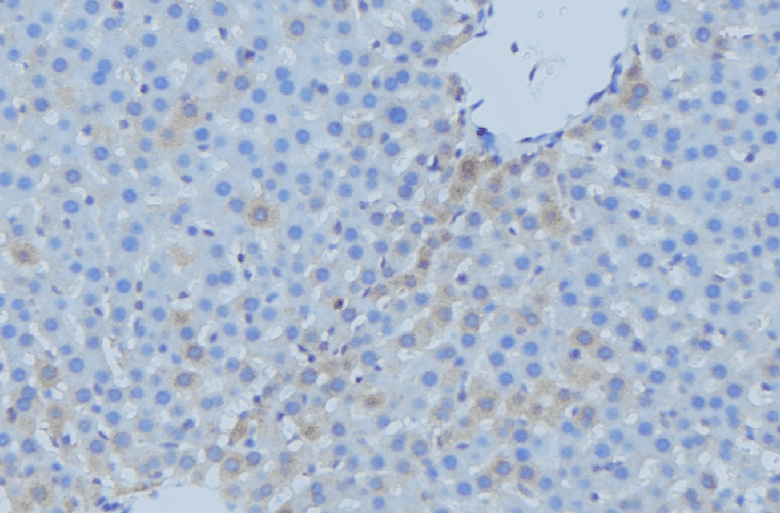 Polyclonal Rabbit anti-Human CYP7A1 Antibody (IHC, WB)