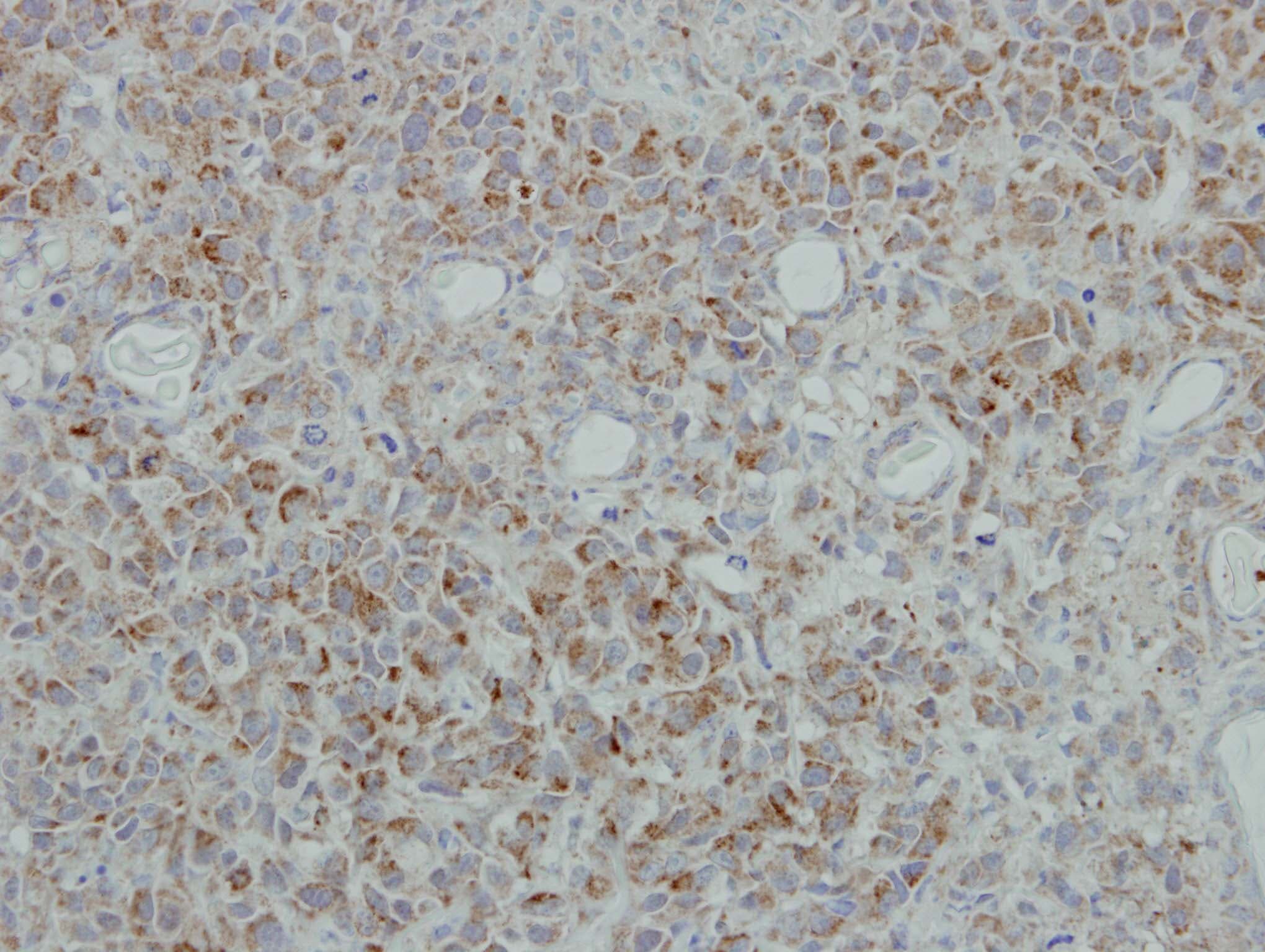 NDUFB5 Antibody (aa126-189)