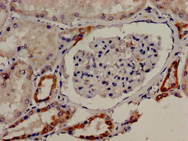 TBC1D4 / AS160 Antibody