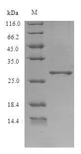 Potato leafroll virus HEV ORF3 Protein (Recombinant 6His, N-terminus)