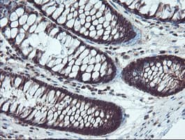 TRAIP / TRIP Antibody (aa67-313, clone OTI2D4, Carrier-free)