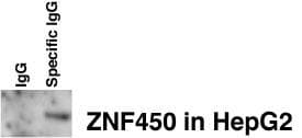 ZBTB24 / BIF1 Antibody (aa137-166)