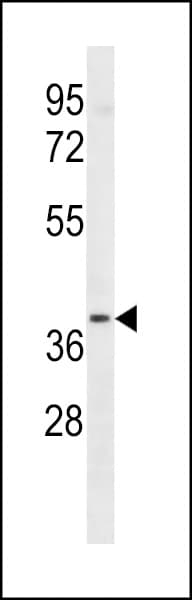 LTB4R2 / BLT2 Antibody (aa333-361)
