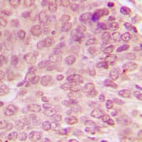 TP53 / p53 Antibody (phospho-Ser15)