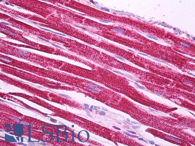 IHC-plus™ Polyclonal Goat anti-Human NDUFS1 Antibody (aa604-616, IHC, WB)