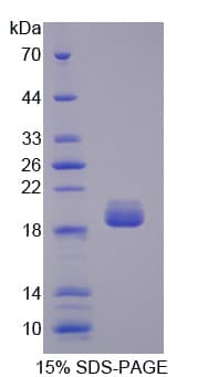 Human PLA2G1B Protein (Recombinant His)