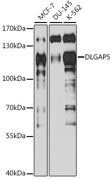 HURP / DLGAP5 Antibody