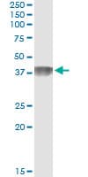 C4BPB / C4BP Beta Antibody (clone 1G9)