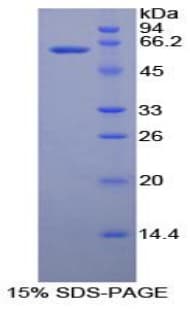 Human RNASET2 Protein (Recombinant His-GST)
