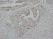 TP73 / p73 Antibody (C-Terminus)