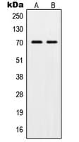 POT1 Antibody (Internal)