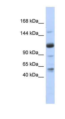 SR140 / U2SURP Antibody (aa71-120)