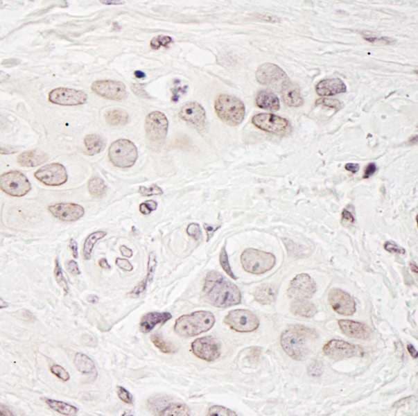 Polyclonal Rabbit anti-Human BCAS3 Antibody (aa870-C-term, IHC, WB)