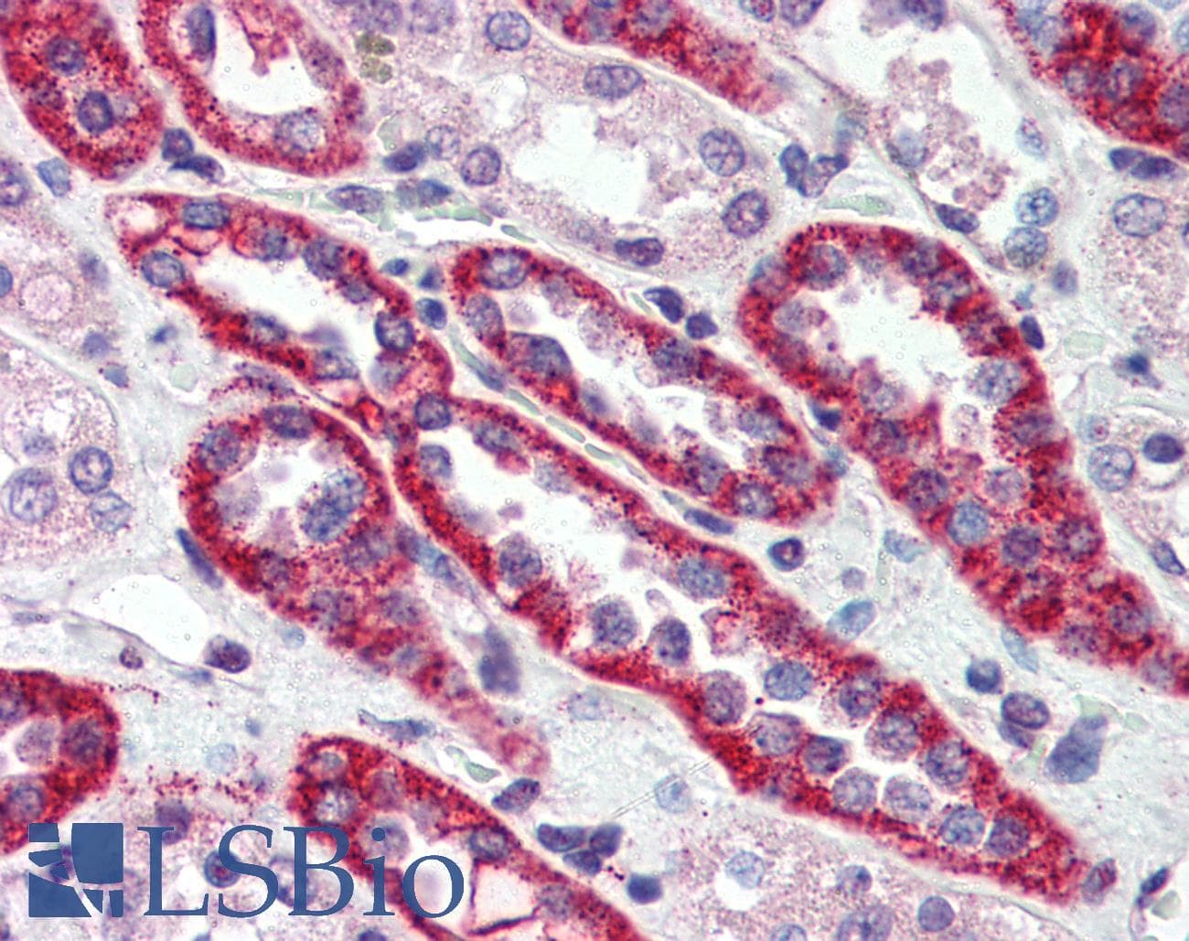 IHC-plus™ CASR/Calcium Sensing Receptor Antibody (N-Terminus)