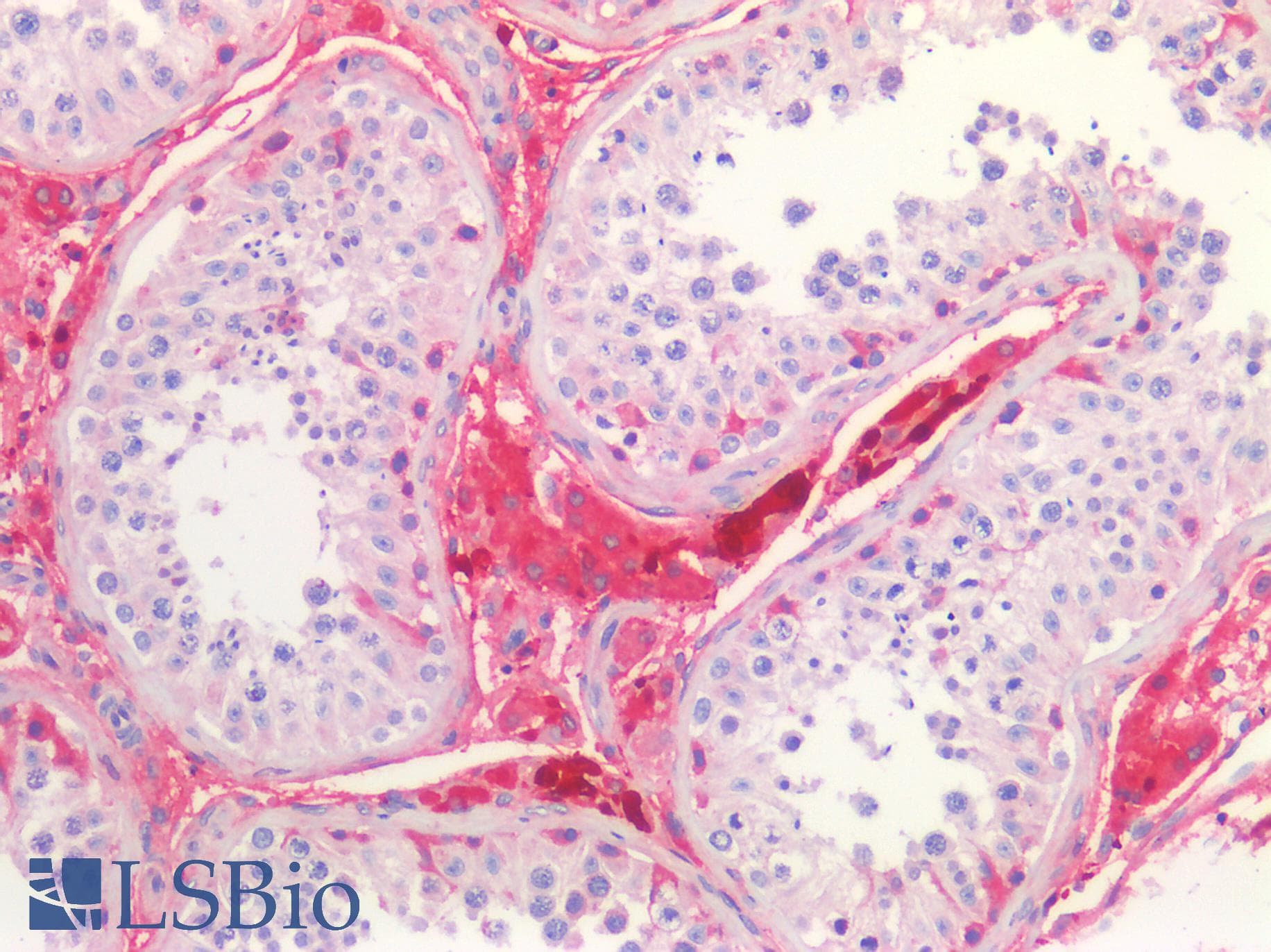 PathPlus™ GLUL / Glutamine Synthetase Antibody
