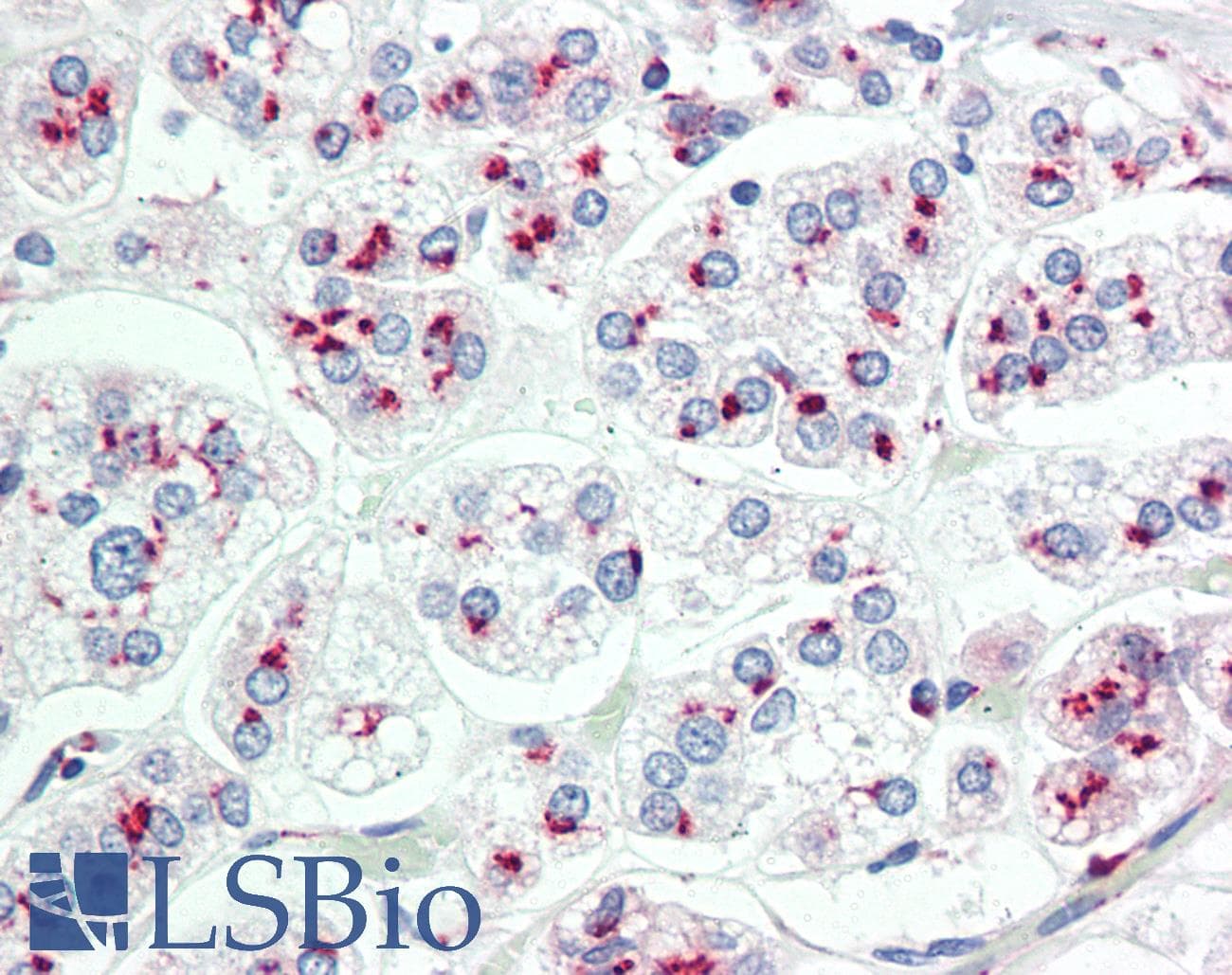 IHC-plus™ LIMD1 Antibody (aa438-467)