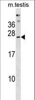 PHOSPHO2 Antibody (aa12-40)