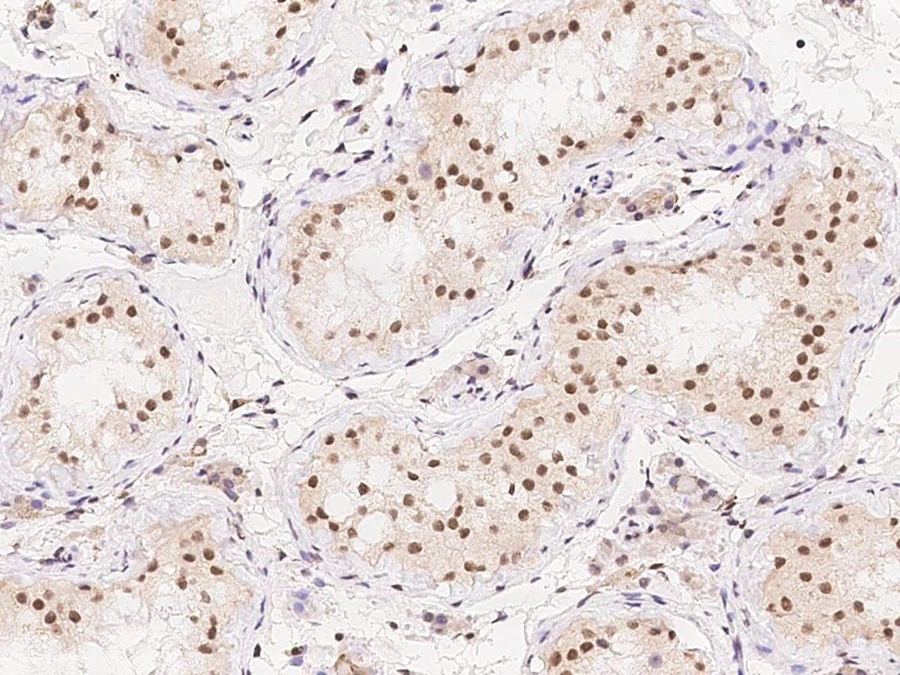 Polyclonal Rabbit anti-Human SKAP / HSD11 Antibody (IHC)