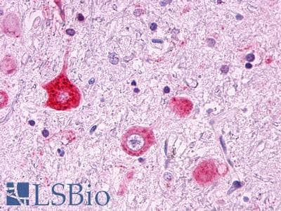 PathPlus™ Polyclonal Rabbit anti-Human GPR151 Antibody (Cytoplasmic Domain, IHC)