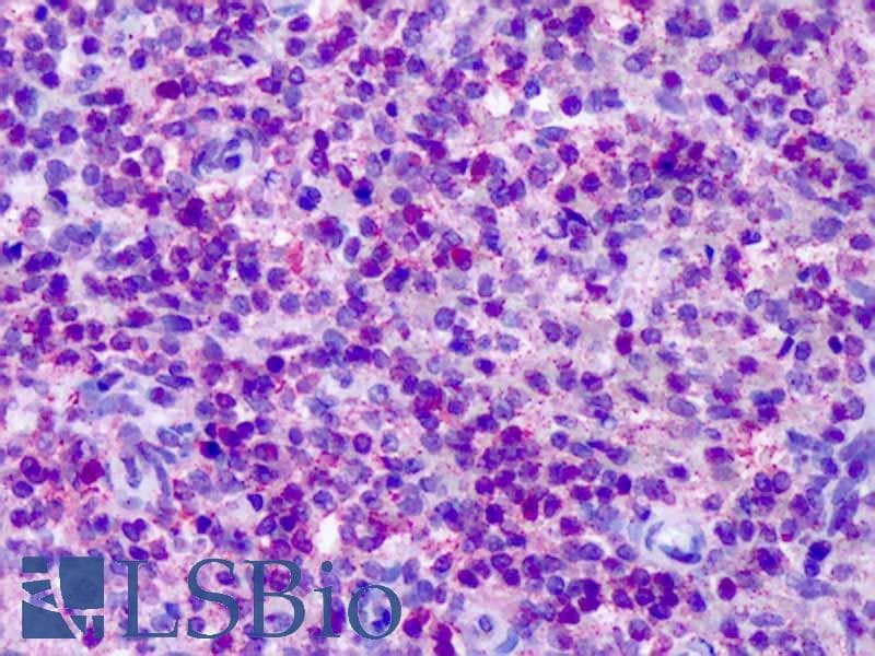 IHC-plus™ CNR2 / CB2 Antibody (C-Terminus)