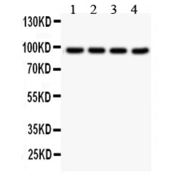 SLC6A4 / SERT Antibody (aa57-85)