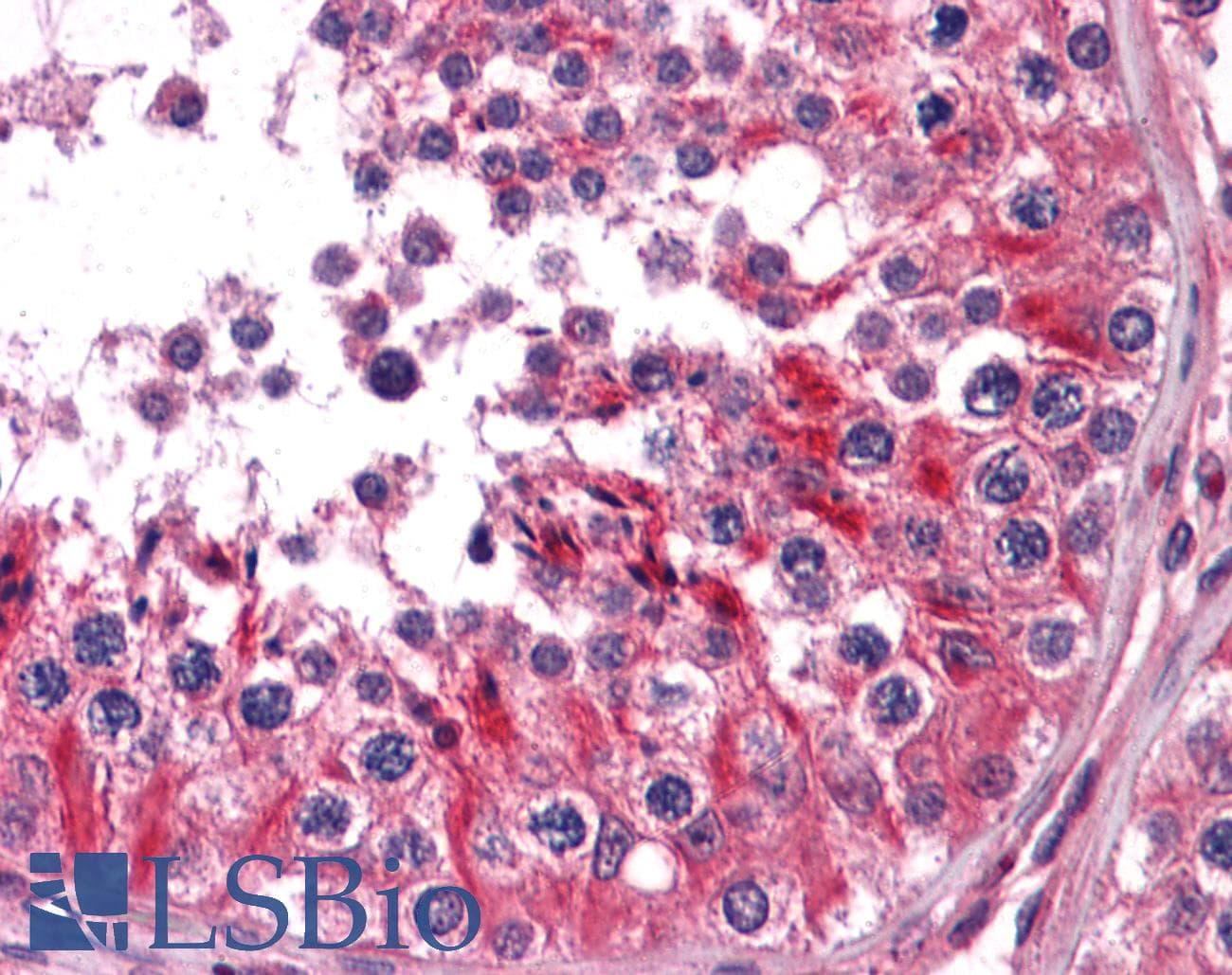 IHC-plus™ TC21 / RRAS2 Antibody (clone 2D3-4B8)