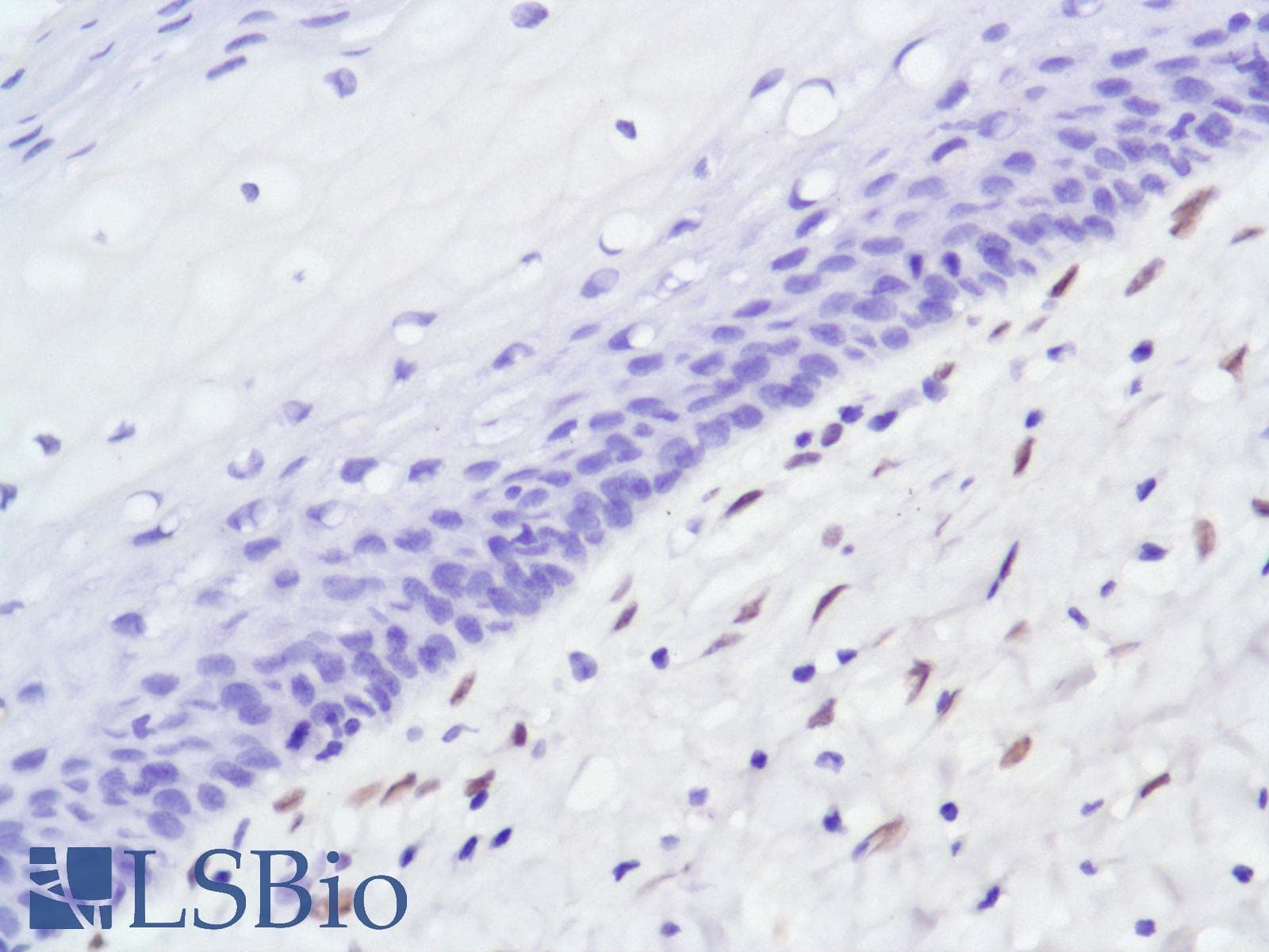 Monoclonal Rabbit anti-Human AR / Androgen Receptor Antibody (clone SP107, N-Terminus, IHC)