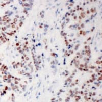 RPS6KA5 / MSK1 Antibody (Internal)