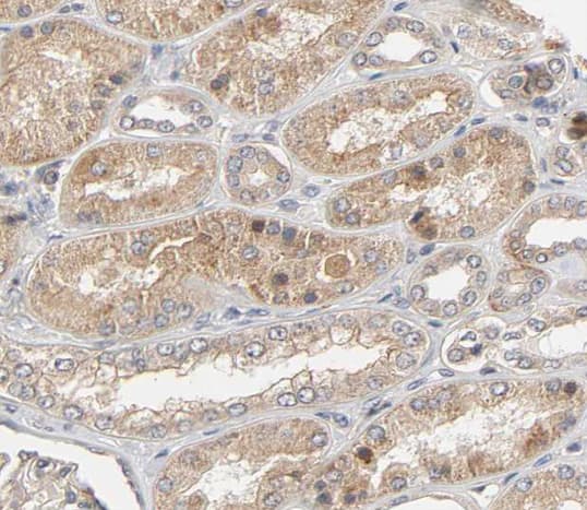 UCN / Urocortin Antibody